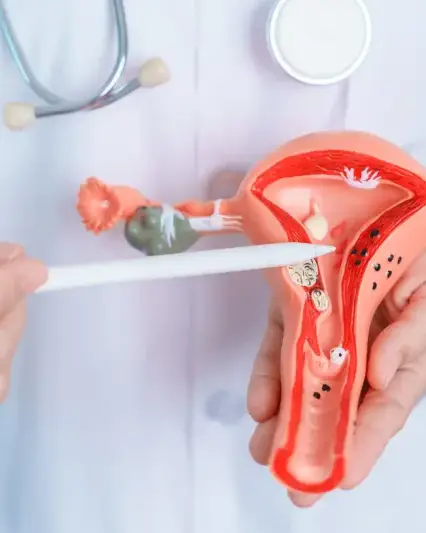 Hipec si cancer ovarian