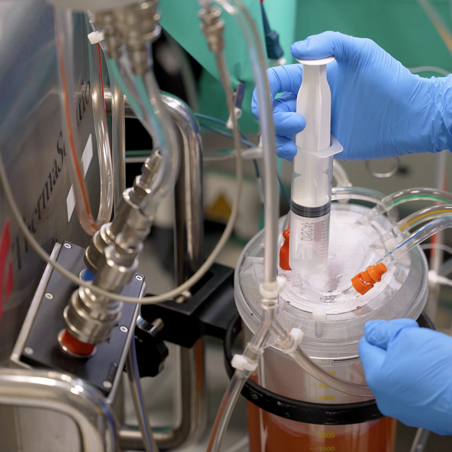 carcinomatoza peritoneala