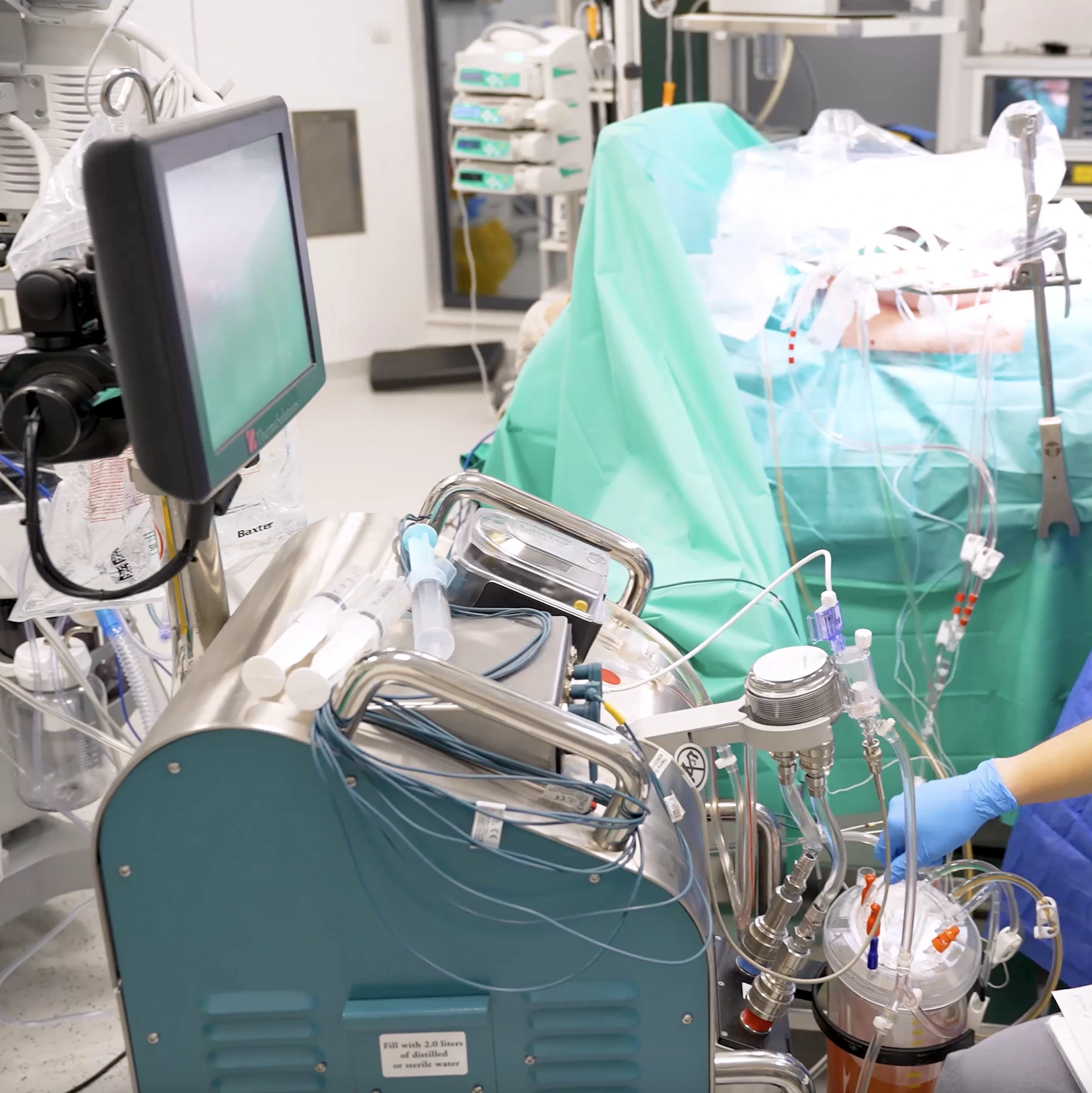 carcinomatoza peritoneala