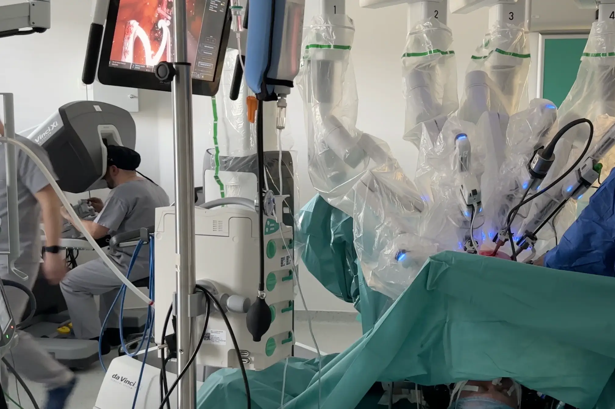 chirurgie minim invaziva robotica