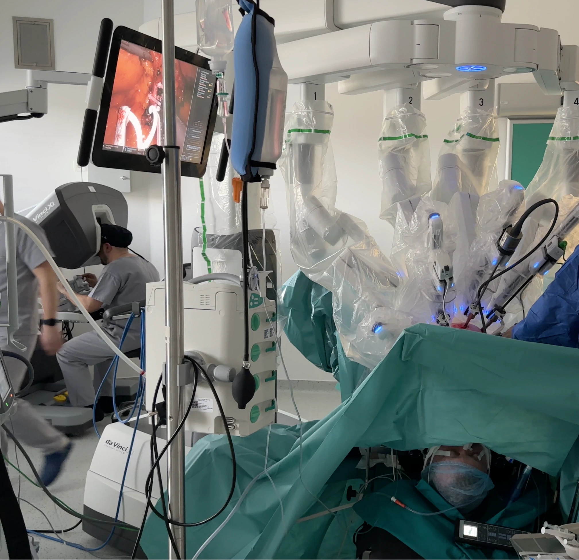 chirurgie minim invaziva robotica