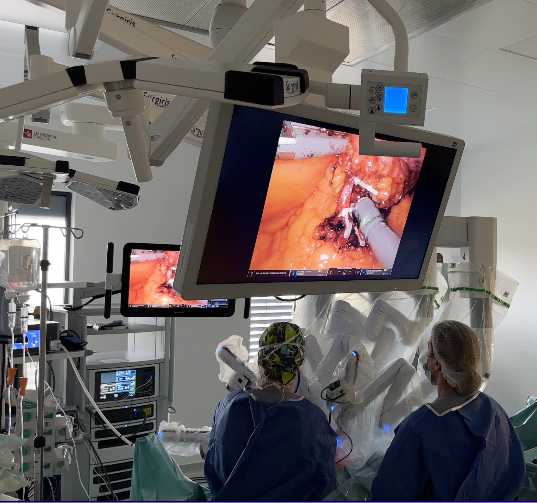 DaVinci Xi in cancerul de pancreas